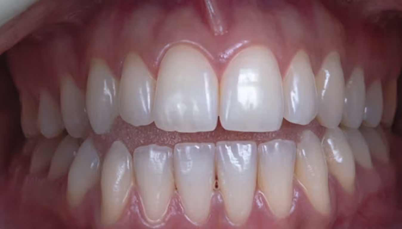 Dental Basics